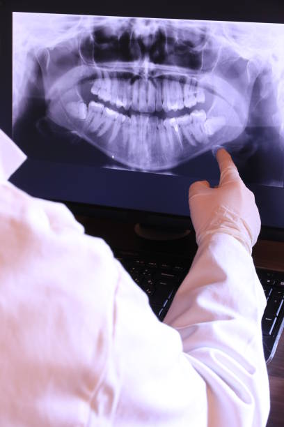 Best Holiday Emergency Dentist in Santee, CA