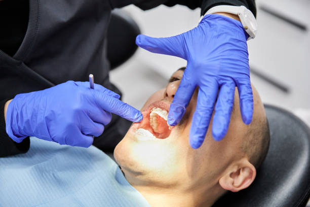Best Emergency Dentist for Knocked-Out Tooth in Santee, CA